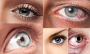 Is Eye Tension a Serious Condition?