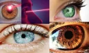 Is Laser Eye Surgery Performed?